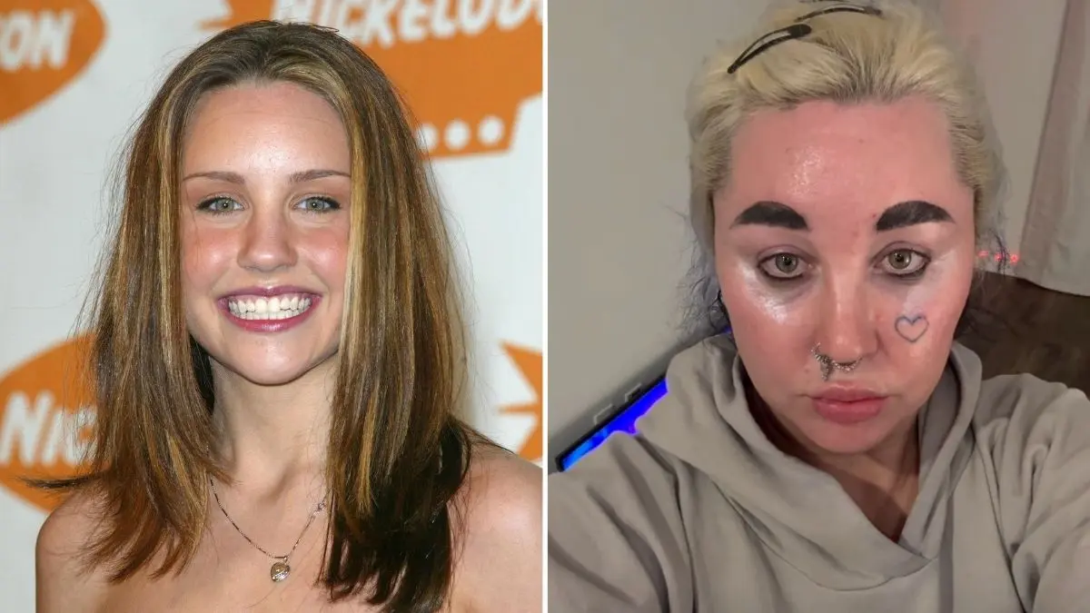 Amanda Bynes opened up about using Ozempic to lose weight.